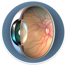 Macular Degeneration Eye Diagram | ClipArt of Eyeball